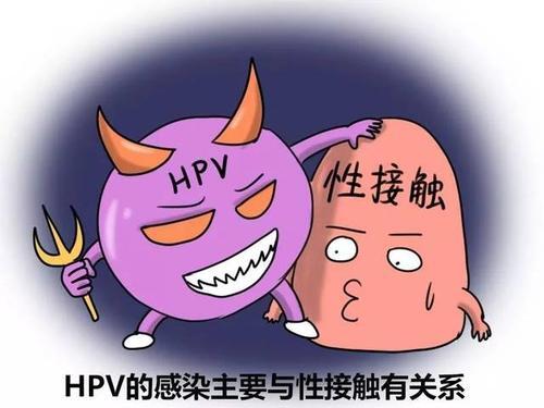 尖锐湿疣是一种什么样的疾病【厦门广肤皮肤病专科医院】